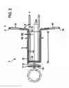 Fig. 03 - Tracheostoma spacer, tracheotomy method, and device for inserting a tracheostoma spacer