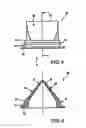Fig. 05 - Tracheostoma spacer, tracheotomy method, and device for inserting a tracheostoma spacer