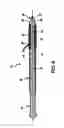 Fig. 06 - Tracheostoma spacer, tracheotomy method, and device for inserting a tracheostoma spacer