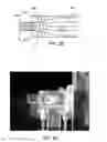 Fig. 03 - Dry powder inhaler