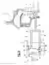 Fig. 14 - PHONATION ASSISTANCE DEVICE FOR A TRACHEOTOMY PATIENT