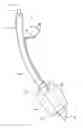 Fig. 02 - Cuff-equipped tube