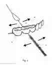 Fig. 06 - Dental flossing material with monofilament threader