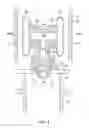 Fig. 05 - Pneumatic vibration dampening device