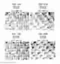 Fig. 21 - Method of making a fabric-creped absorbent cellulosic sheet