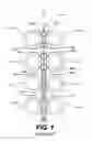 Fig. 02 - INFLATABLE SPREADING TOOL