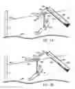 Fig. 05 - Braking system for a zip line