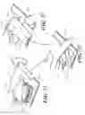 Fig. 28 - Catheter tray, packaging system, instruction insert, and associated methods