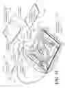 Fig. 33 - Catheter tray, packaging system, instruction insert, and associated methods