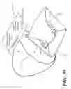 Fig. 34 - Catheter tray, packaging system, instruction insert, and associated methods