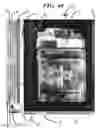 Fig. 35 - Catheter tray, packaging system, instruction insert, and associated methods