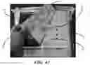 Fig. 37 - Catheter tray, packaging system, instruction insert, and associated methods