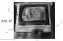 Fig. 40 - Catheter tray, packaging system, instruction insert, and associated methods