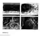 Fig. 07 - Device for renal cell expansion