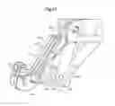Fig. 10 - MECHANICAL METHOD AND APPARATUS FOR BILATERAL TISSUE FASTENING