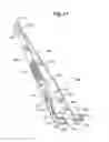 Fig. 12 - MECHANICAL METHOD AND APPARATUS FOR BILATERAL TISSUE FASTENING