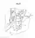 Fig. 16 - MECHANICAL METHOD AND APPARATUS FOR BILATERAL TISSUE FASTENING