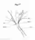 Fig. 41 - MECHANICAL METHOD AND APPARATUS FOR BILATERAL TISSUE FASTENING