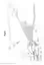 Fig. 48 - MECHANICAL METHOD AND APPARATUS FOR BILATERAL TISSUE FASTENING