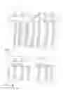 Fig. 07 - Infrared range-finding and compensating scope for use with a projectile firing device