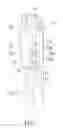 Fig. 02 - Hanger for window drape and slide assembly including hanger