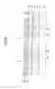 Fig. 07 - LIGHT EMITTING DEVICE