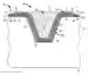 Fig. 01 - High density three-dimensional integrated capacitors