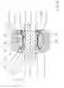 Fig. 12 - Bearing mechanism for a transverse leaf spring, mountable in the area of a vehicle axle