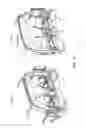 Fig. 05 - Deformable Cross-Car Beam for Side Impact Protection