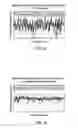 Fig. 07 - System and method for reducing localized signal fluctuation