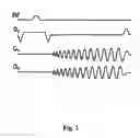 Fig. 04 - Multi-dimensional cardiac and respiratory imaging with MRI