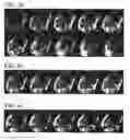 Fig. 06 - Multi-dimensional cardiac and respiratory imaging with MRI
