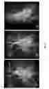 Fig. 07 - Magnetic resonance imaging with high spatial and temporal resolution