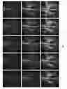 Fig. 08 - Magnetic resonance imaging with high spatial and temporal resolution