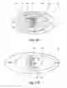 Fig. 04 - Magnetic field unit of an MRT system for image capturing a head region