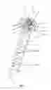 Fig. 02 - Self-deploying helical antenna