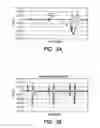 Fig. 03 - Pressure and transfix rollers for a solid ink jet printing apparatus