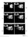 Fig. 07 - 3D image generation
