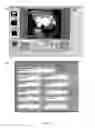 Fig. 06 - VIDEO CAMERA SYSTEM