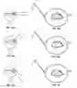 Fig. 02 - ADJUSTABLE EYEWEAR, LENSES AND FRAMES