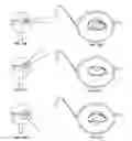 Fig. 02 - Translating multifocal eyeglass lenses