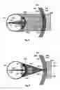Fig. 15 - Method and apparatus for constructing a contact lens with optics