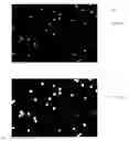 Fig. 06 - Method and apparatus for detecting and counting platelets individually and in aggregate clumps
