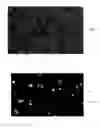 Fig. 07 - Method and apparatus for detecting and counting platelets individually and in aggregate clumps