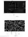 Fig. 08 - Method and apparatus for detecting and counting platelets individually and in aggregate clumps