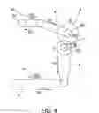 Fig. 04 - Linkage mechanism, a collimator, and an X-ray machine