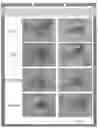 Fig. 03 - METHOD AND SYSTEM FOR ESTIMATING THE PERCEIVED AGE OF AN INDIVIDUAL
