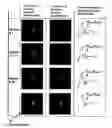 Fig. 01 - Unifying reconstruction and motion estimation in first pass cardiac perfusion imaging