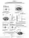 Fig. 05 - Making different corrections for different areas of magnetic resonance image data