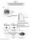 Fig. 07 - Making different corrections for different areas of magnetic resonance image data
